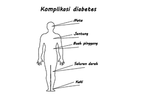 mencegah -kerumitan