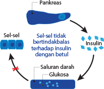 Definition and types of diabetes