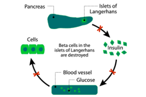 Definition and types of diabetes