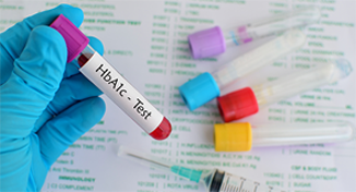 What Are The Tests For Type 1 And Type 2 Diabetes?