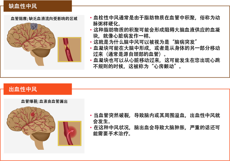 How is high blood pressure related to stroke?