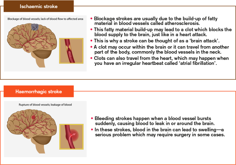Do you have high deals blood pressure with a stroke
