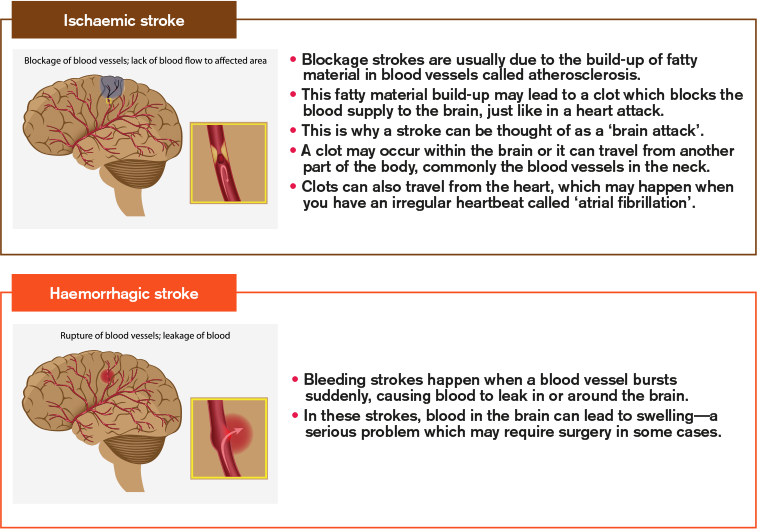 How is high blood pressure related to stroke