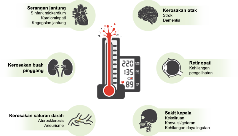 Apakah kepentingan merawat tekanan darah tinggi?